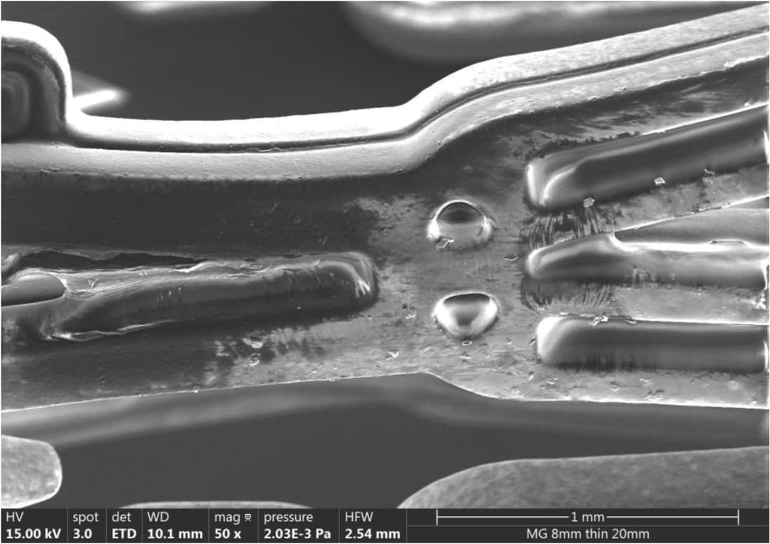 Illustration of bioresorbable stent usage
